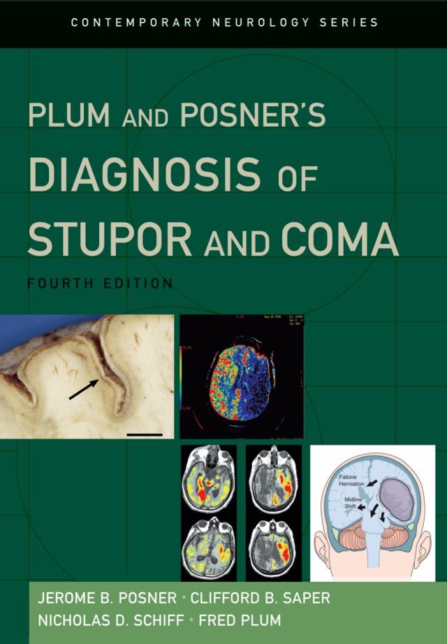 stupor-and-coma.jpg